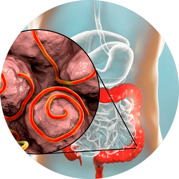 Kuņģa-zarnu trakts un parazīti