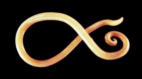nematodes tārps no cilvēka ķermeņa