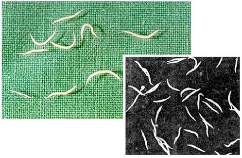 pinworms no cilvēka ķermeņa